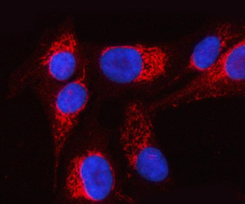 Anti-PTPIP51/RMDN3 Antibody