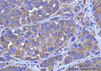 Anti-PTPIP51/RMDN3 Antibody