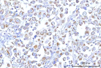 Anti-PTPIP51/RMDN3 Antibody