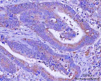 Anti-PTPIP51/RMDN3 Antibody