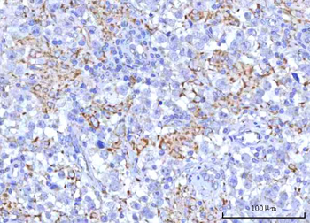 Anti-PTPIP51/RMDN3 Antibody