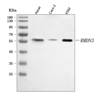 Anti-PTPIP51/RMDN3 Antibody