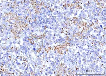 PTPIP51/RMDN3 Antibody