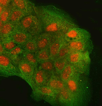 Anti-RGS9 Antibody