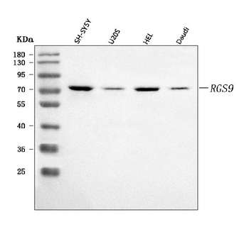 Anti-RGS9 Antibody