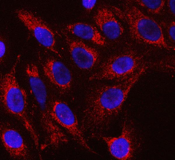 Anti-RFTN1 Antibody