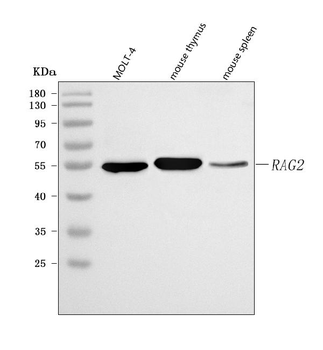 Anti-RAG2 Antibody
