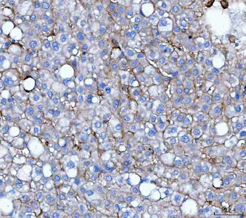 Anti-CD276 Antibody