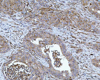 Anti-CD276 Antibody