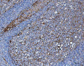 Anti-CD276 Antibody