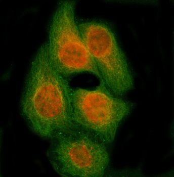 Anti-RBM14 Antibody