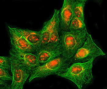 Anti-RASSF2 Antibody