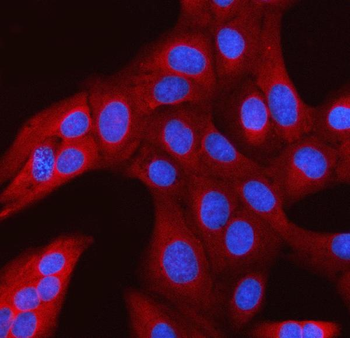 RANBP1 Antibody