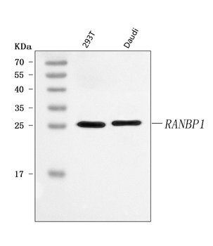 Anti-RANBP1 Antibody