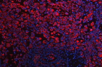 Anti-RPS5 Antibody