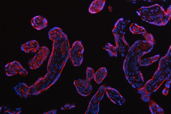 Anti-RPS5 Antibody