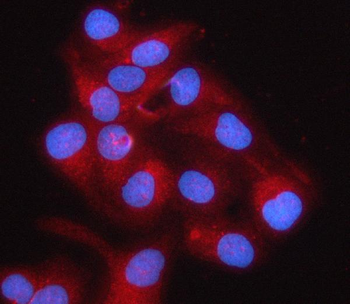 Anti-RPS5 Antibody