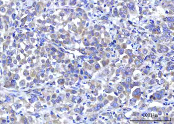 Anti-RPS5 Antibody