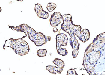 Anti-RPS5 Antibody