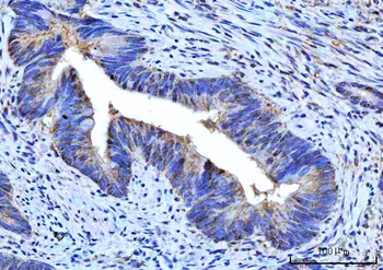 Anti-RPS5 Antibody