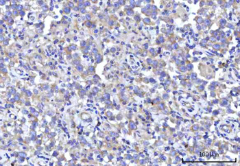 Anti-RPS5 Antibody