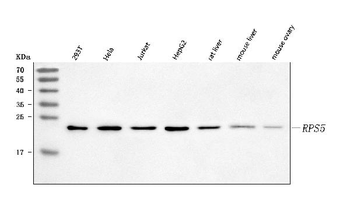 Anti-RPS5 Antibody