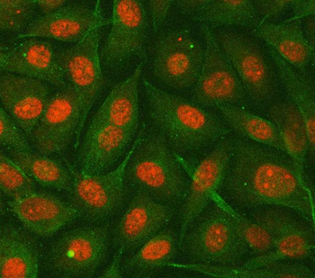 Anti-hnRNP E2/PCBP2 Antibody