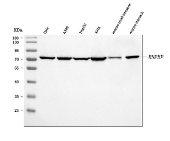 Anti-AP-B/RNPEP Antibody