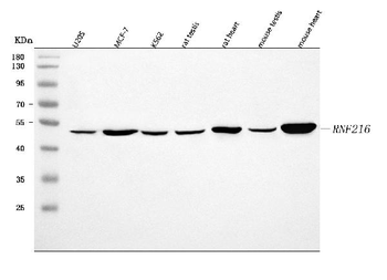 RNF216 Antibody