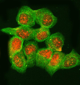 Anti-RNASEH2B Antibody