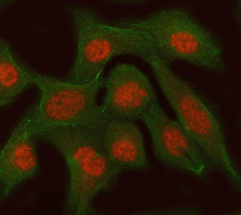 Anti-RFC3 Antibody