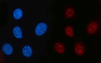 Anti-RFC2 Antibody