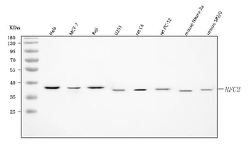 Anti-RFC2 Antibody