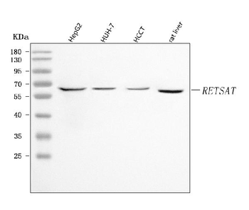 Anti-RETSAT Antibody