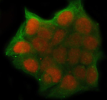 Anti-UHRF1 Antibody
