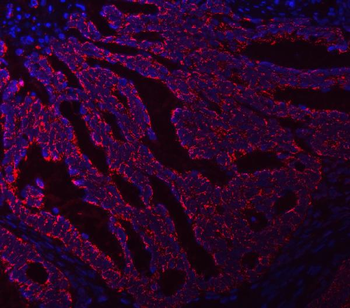 Anti-Asparagine synthetase/ASNS Antibody