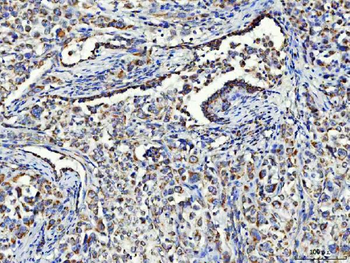 Anti-Asparagine synthetase/ASNS Antibody