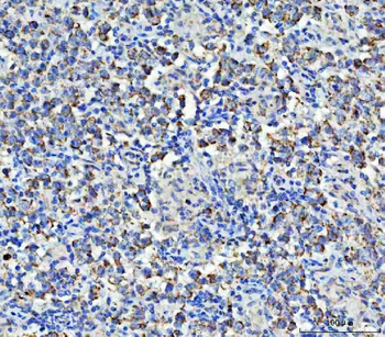Anti-Asparagine synthetase/ASNS Antibody