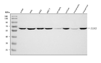 Anti-Asparagine synthetase/ASNS Antibody