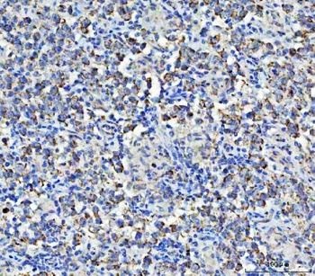 Asparagine synthetase/ASNS Antibody