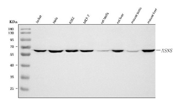 Asparagine synthetase/ASNS Antibody