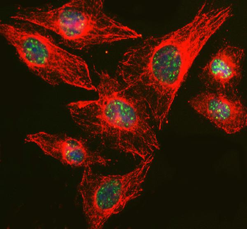 Anti-RBM25 Antibody