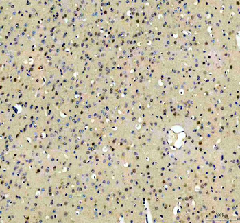 Anti-RBM25 Antibody