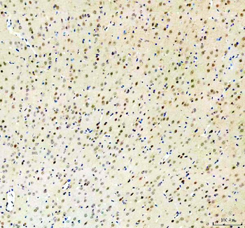 Anti-RBM25 Antibody