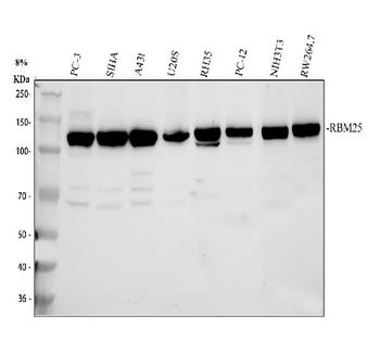 Anti-RBM25 Antibody