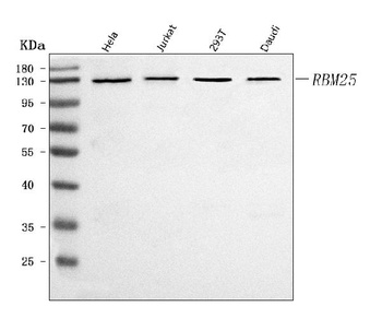 RBM25 Antibody