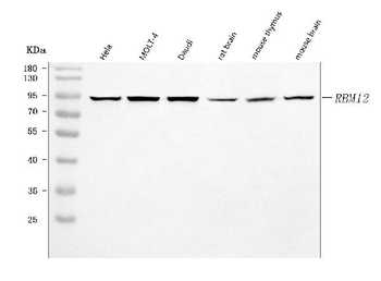 SWAN/RBM12 Rabbit Polyclonal Antibody