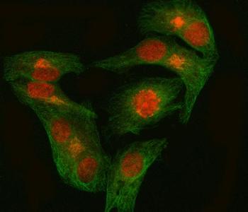 Anti-EZH1 Antibody