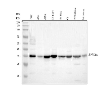 Anti-P15RS/RPRD1A Antibody
