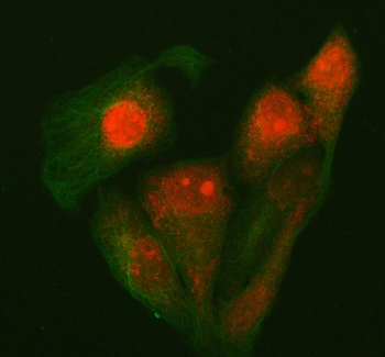 Anti-P15RS/RPRD1A Antibody